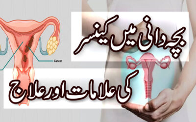 Bache Dani Uterus Cancer Alamat Aur Ilaj