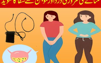 Masana Ki Kamzori Ka Ilaj | Urine Problem In Urdu