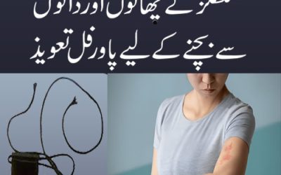 Shingles Ka Ilaj In Urdu | Taweez For Shingles Rash