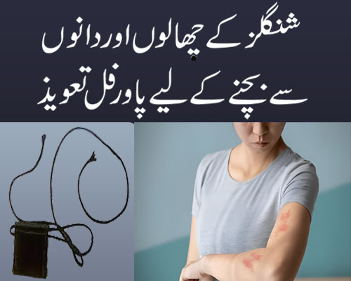 Shingles Ka Ilaj In Urdu | Taweez For Shingles Rash