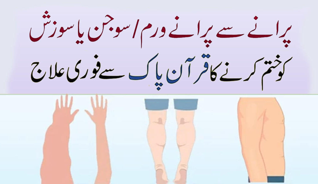 Taweez For Swelling In Body