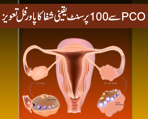 PCOS Se 100% Shifa Ka Powerful Taweez | Ovarian Cyst/PCOS & Pregnancy Treatment In Urdu