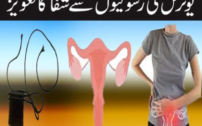 Uterus Ki Rasoli Se Shifa Ka Taweez | Fibroid Treatment In Quran