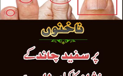 Nakhun Par Safed Nishan Ka Matlab | White Marks On Nails