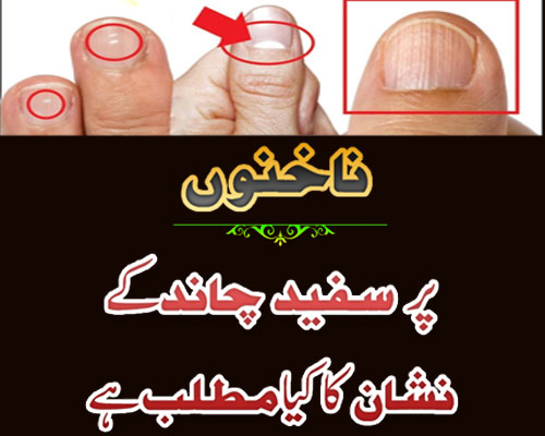 Nakhun Par Safed Nishan Ka Matlab | White Marks On Nails