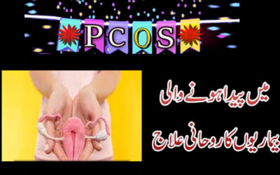 PCOS Ki Bimariyon Se Shifa Ka Taweez