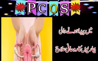 PCOS Ka Ilaj |PCOS Main Paida Hony Wali Bemari Ka Ilaj |Hormones Ki Kharabi Ka ilaj