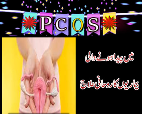 PCOS Ka Ilaj |PCOS Main Paida Hony Wali Bemari Ka Ilaj |Hormones Ki Kharabi Ka ilaj