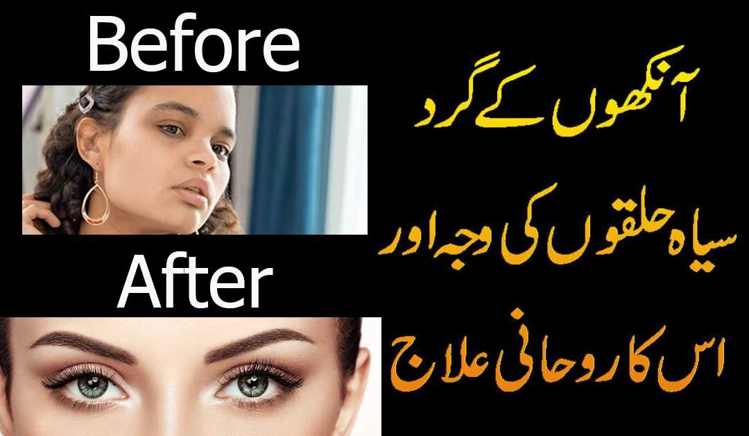 Dark Circle Ka Taweez