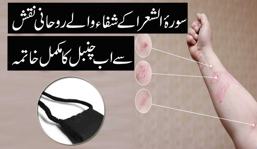 Chambal Ki Bimari Se Shifa Ka Taweez