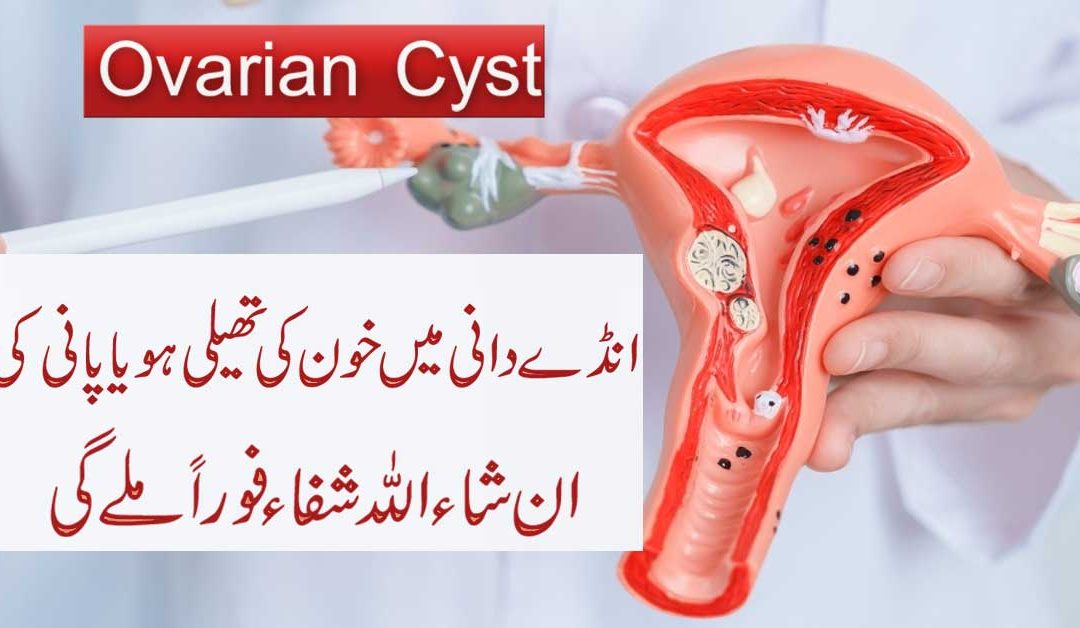 Treatment of blood cysts/water cysts in Anedani