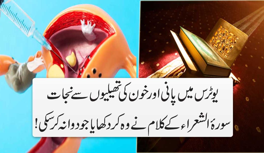 Andedani Mein Pani Ki Tehli/Khoon Ki Thelion Se Shifa