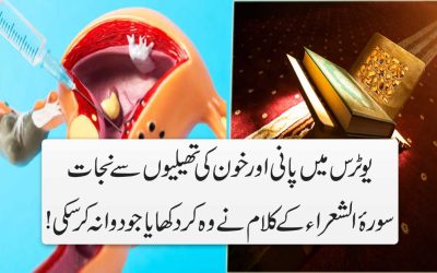 Cyst Ka Rohani Ilaj In Quran