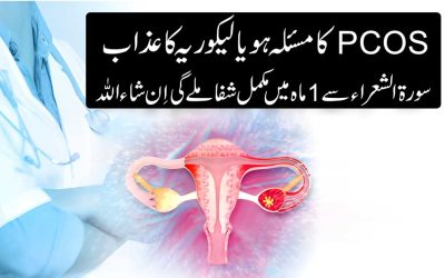 PCOS Se Shifa Ka Naqsh