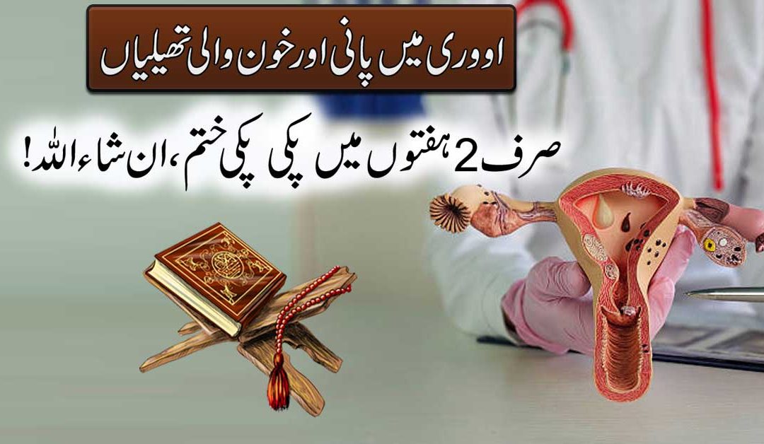 Ovarian Cyst Treatment